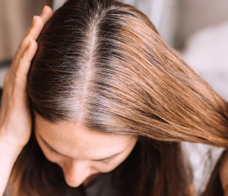 Capelli bianchi da giovani